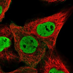 ZNF655 Antibody, Novus Biologicals 25 &mu;L; Unlabeled:Antibodies, Polyclonal